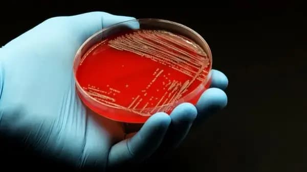 Traditional mastitis culture plates